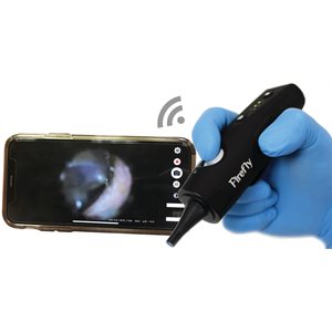 Firefly DE570 Wireless HD Digital Video Otoscope for Smart Phones & Tablets