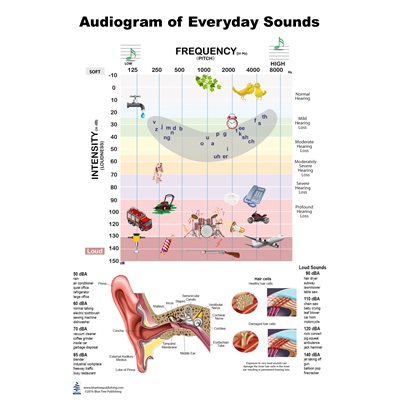 Blue Tree Audiogram LP Poster (24"W x 36"H)