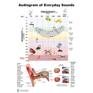 Blue Tree Audiogram LP Poster (24"W x 36"H)