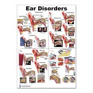 Blue Tree Ear Disorders LP Poster (24"W x 36"H)