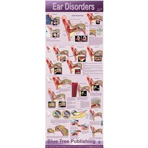 Blue Tree Ear Disorders XLP Poster (30"W x 84"H) - Wall Hanging Version